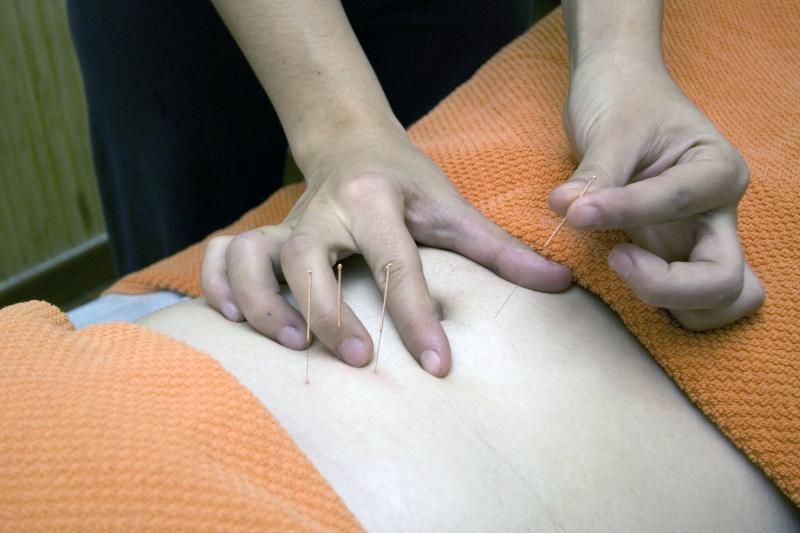 osteopathe-MAZAUGUES-min_acupuncture-4175625